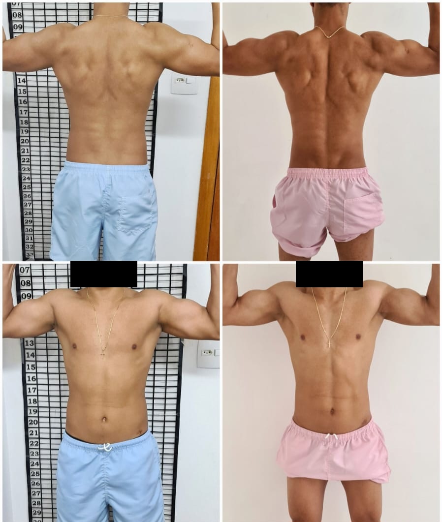 Comparação antes e depois 5, com rostos preservados em privacidade